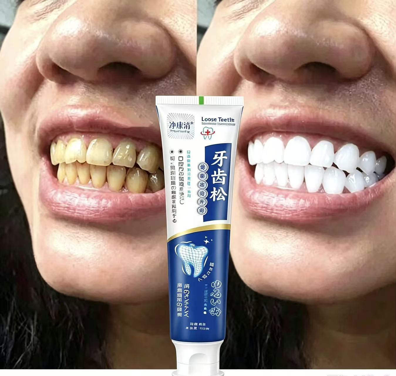 Teeth Whitening Japanese - Fix Loose Teeth Japanse geïmporteerde tandpasta