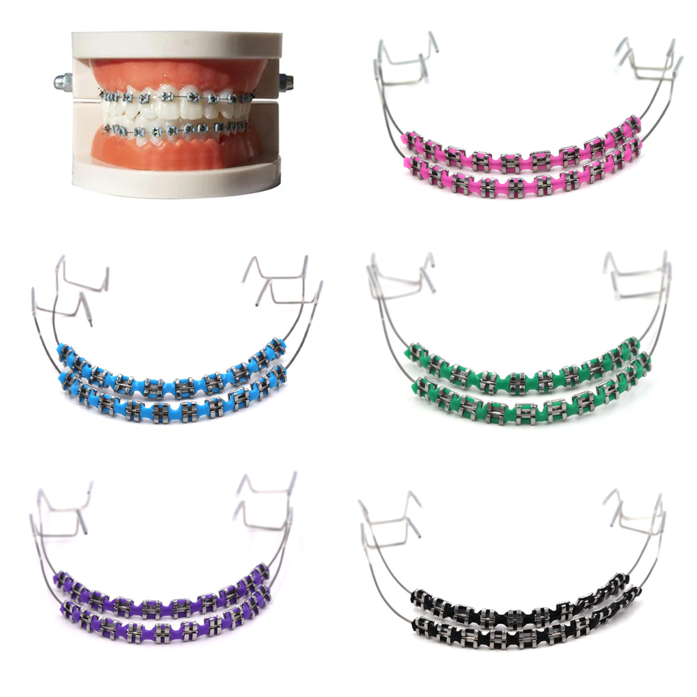 Teeth Whitening Mouth Guard - Mode nepbeugelset - Kleurrijke orthodontische ligatuurbanden