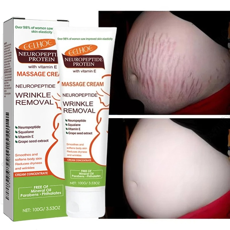 Teeth Whitening Pregnancy - 100g Striae Permanente Verwijdering Crème Moederschap