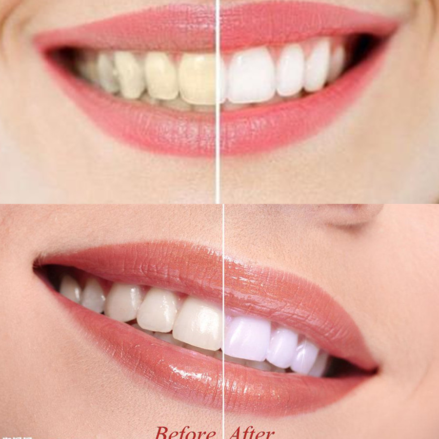 Bamboe Houtskool Tanden Dental - Teeth Whitening Charcoal Powder recensie en prijs