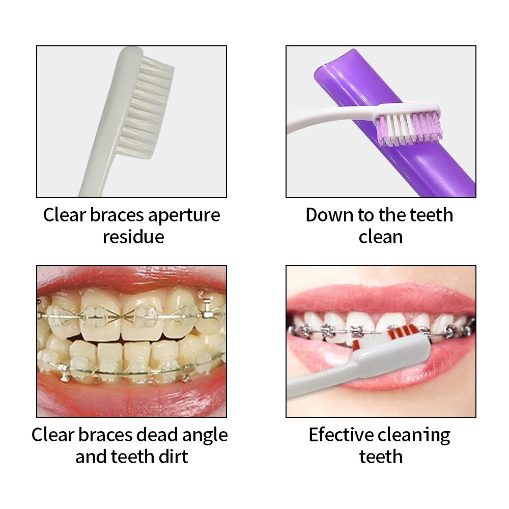 8 stks/set Orthodontische Tand - Teeth Whitening Brush recensie en prijs