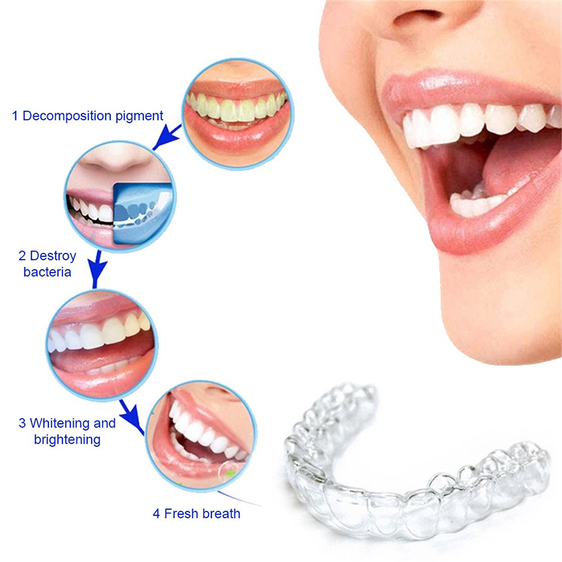 Comfort Fit Siliconen Mondbakj - Teeth Whitening Mouth Guard recensie en prijs