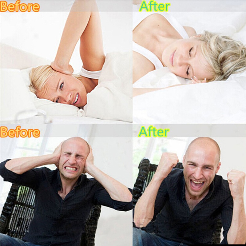 Siliconen anti-tandknarsmondbe - Teeth Whitening Mouth Guard recensie en prijs