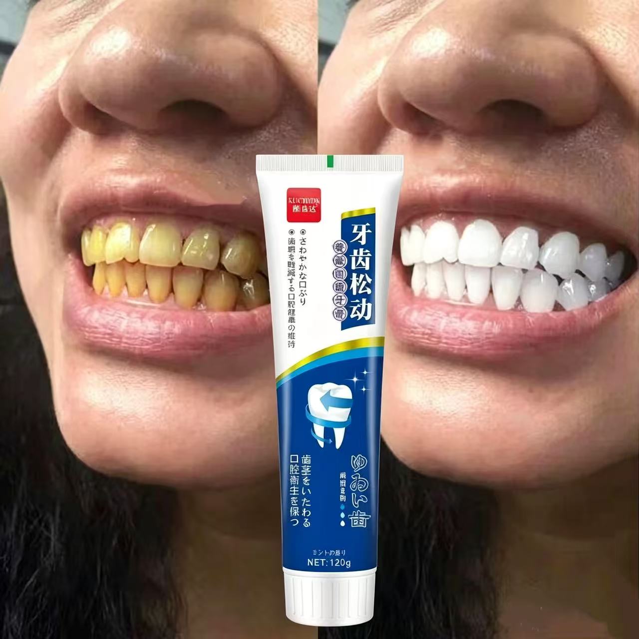 Fix Loose Teeth Japanse geïmpo - Teeth Whitening Japan recensie en prijs