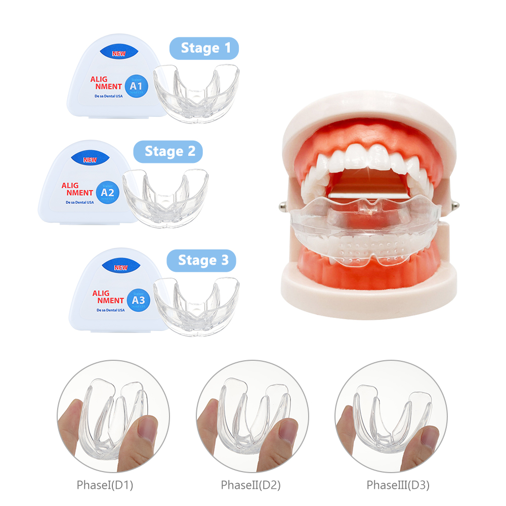 Tandheelkundige Orthodontische - Teeth Whitening Mouth Guard recensie en prijs