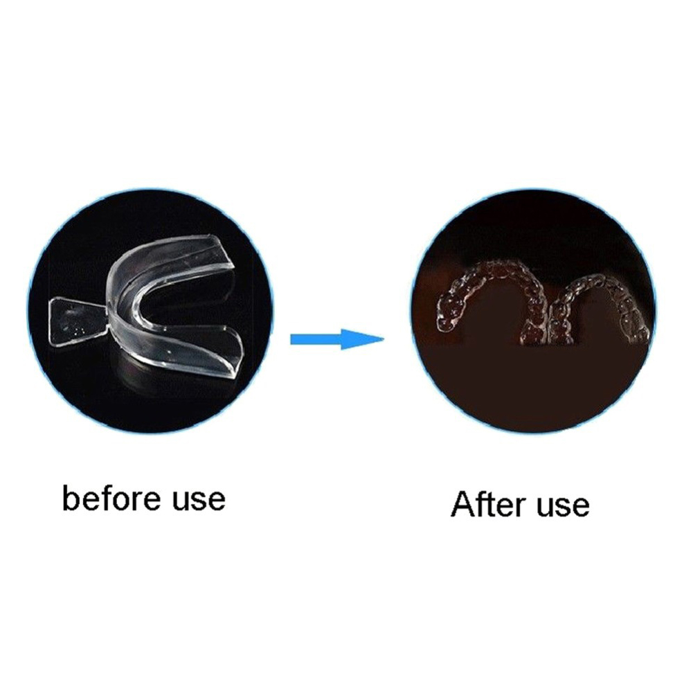 2/4 Stuks Zachte Tand Orthodon - Teeth Whitening Mouth Guard recensie en prijs