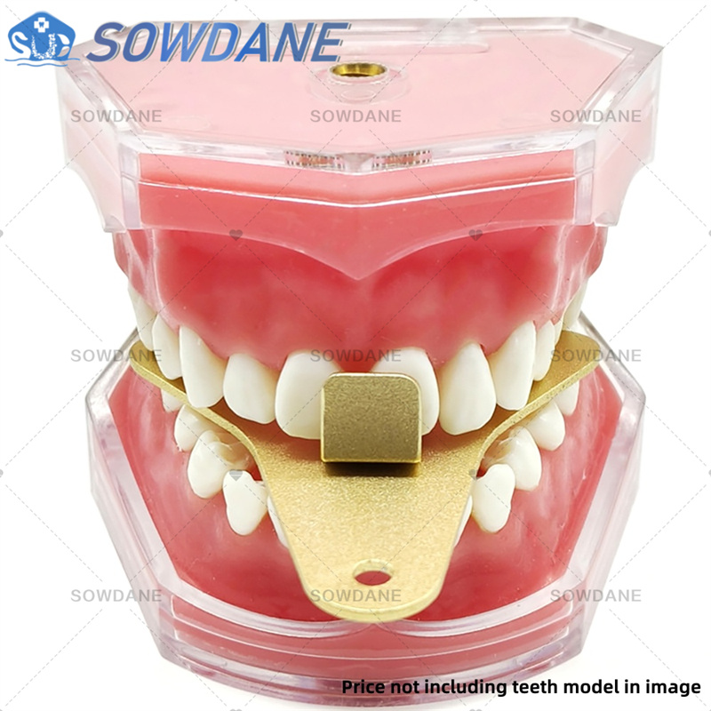 Dental Lab Afdruklepels om Cen - Teeth Whitening Trays recensie en prijs