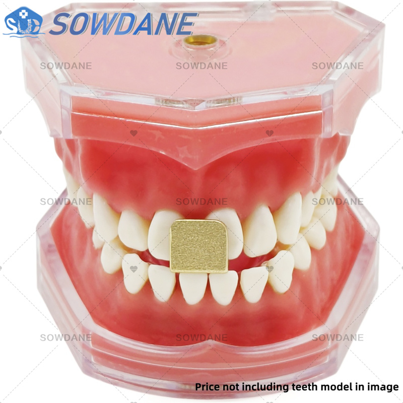 Dental Lab Afdruklepels om Cen - Teeth Whitening Trays recensie en prijs
