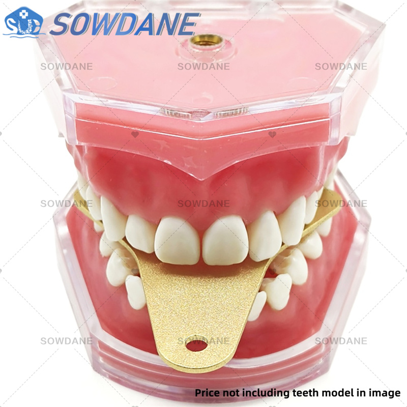 Dental Lab Afdruklepels om Cen - Teeth Whitening Trays recensie en prijs