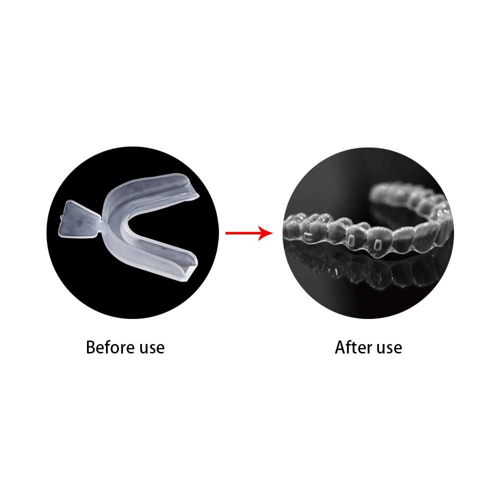 Beschermer Bruxisme Tandenhoez - Teeth Whitening Mouth Guard recensie en prijs