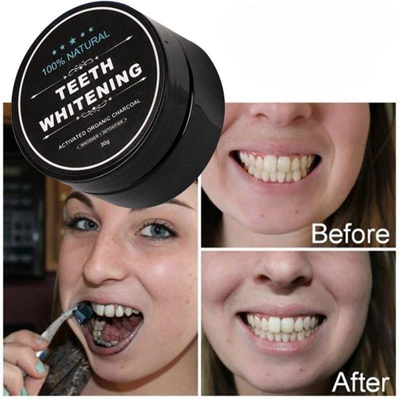1 doos geactiveerd houtskool t - Teeth Whitening Charcoal Powder recensie en prijs