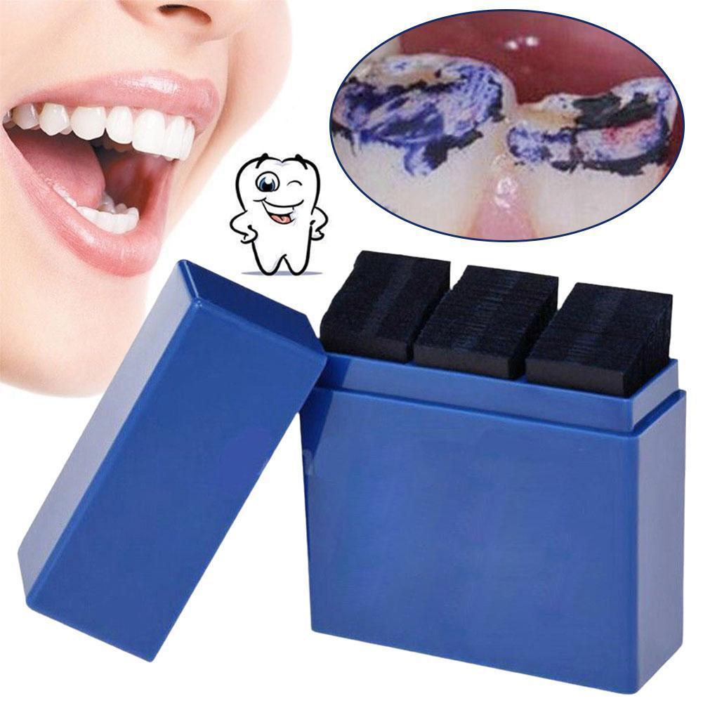 300 Vellen Tandheelkundige Art - Teeth Whitening Professional recensie en prijs