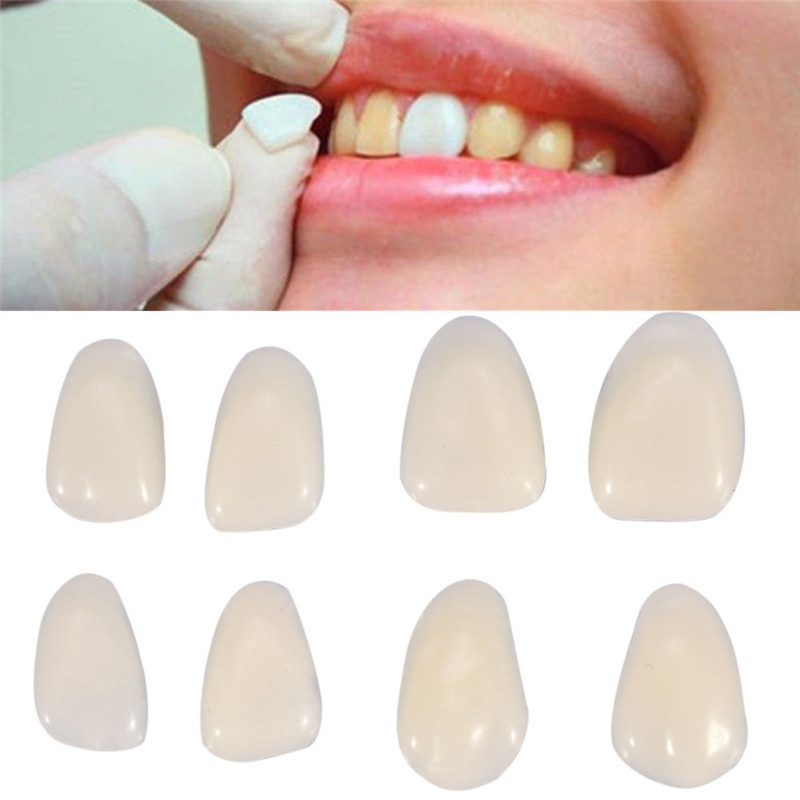 Tandheelkundige valse tanden T - Teeth Whitening Professional recensie en prijs