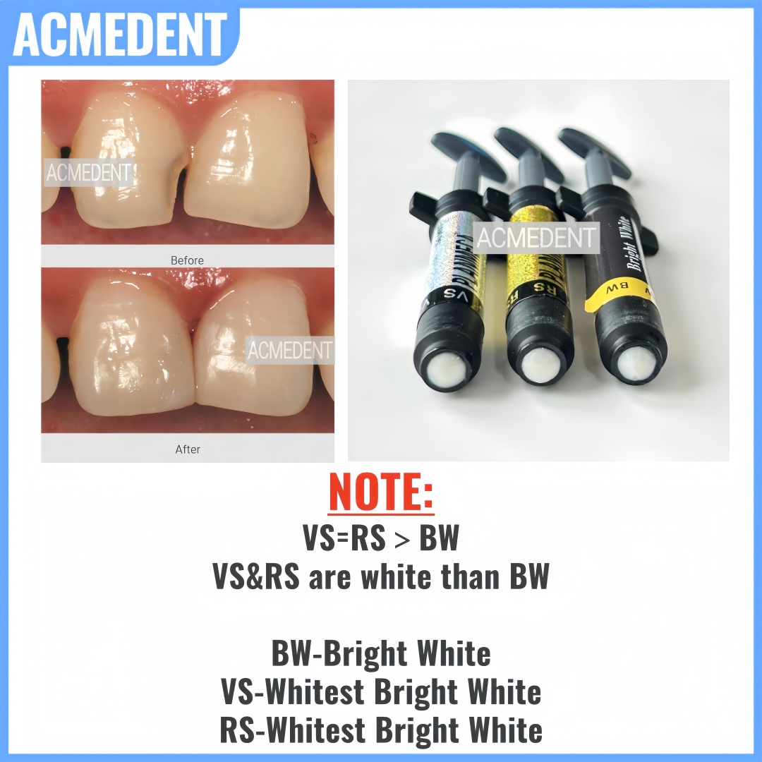 4.5g Tandheelkundige Composiet - Teeth Whitening Vs Veneers recensie en prijs